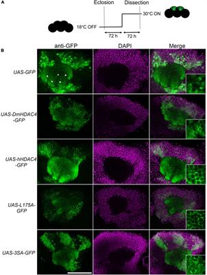 Increased Abundance of Nuclear HDAC4 Impairs Neuronal Development and Long-Term Memory